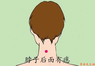 脖子后面有痣