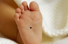 男宝宝脚底心长痣意味着什么？