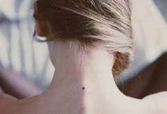 女人脖子后面有痣点位置图解！