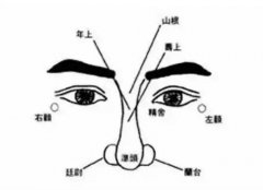 鼻孔下有痣的女人面相分析，鼻子有痣其它情况解析